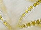 Dettaglio degli organi pluriloculari